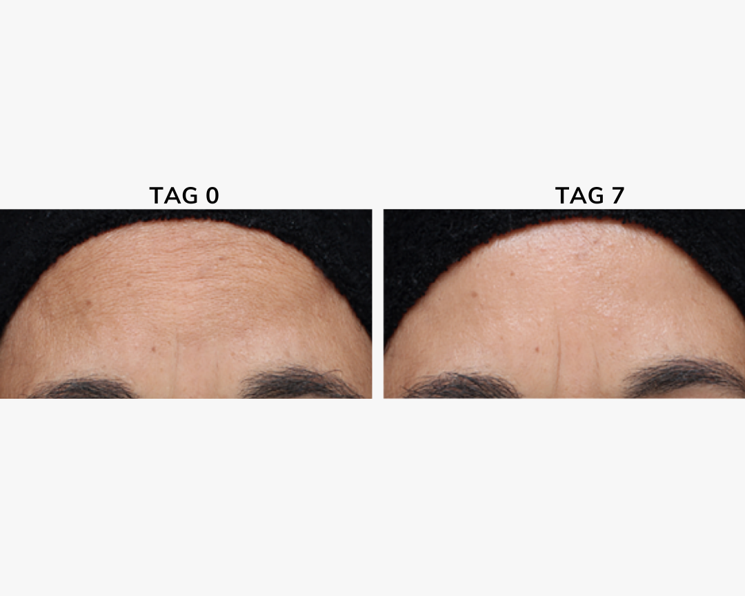 Age Spot Cream Serum 30 ml